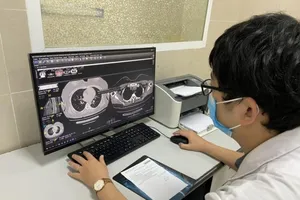 Những ai cần đi khám xơ phổi sau khi khỏi COVID-19?