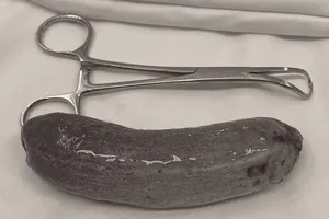 Sửng sốt dị vật 'khủng' trong hậu môn nam thanh niên 19 tuổi