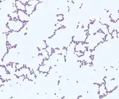 Người đàn ông bán thịt nhiễm liên cầu khuẩn lợn 