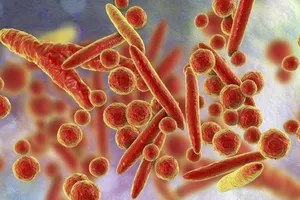 Dấu hiệu nhận biết trẻ viêm phổi do Mycoplasma