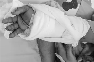 Cứu bàn tay đứt lìa nhờ được xử lý đúng cách trước khi đến bệnh viện