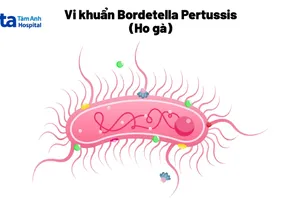 Làm sao để biết bị ho thường hay ho gà?