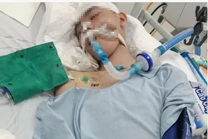 Bệnh viện thông tin về sức khỏe nam sinh lớp 8 bị đánh chấn thương sọ não