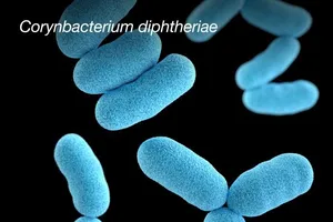 Các biến chứng nguy hiểm của bệnh bạch hầu, có thể gây tử vong