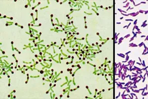 Nữ sinh tử vong do bạch hầu ở Nghệ An có tiếp xúc với 119 người