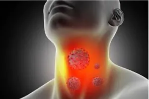 Ung thư vòm họng chữa được không?