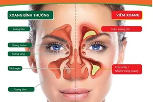 (Ảnh minh họa: Internet)