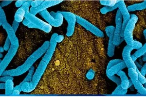 Triệu chứng bệnh do virus Marburg