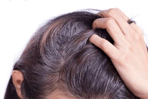 Tại sao càng nhuộm tóc bạc càng nhanh và nhiều?