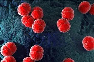 Não mô cầu có lây không?