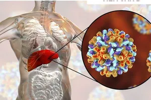 Viêm gan B cấp nguy hiểm đến mức nào?