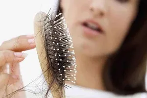 Những điều cần biết trước khi điều trị rụng tóc