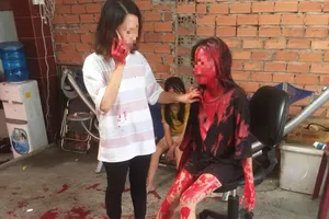 Cô gái 21 tuổi bị tạt sơn khắp người