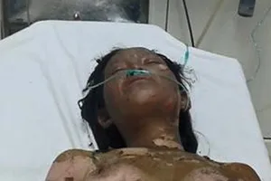 Tưới xăng đốt chết con, vợ bỏng nặng