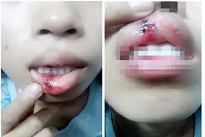 Công an Đồng Nai làm việc với nạn nhân vụ clip bị đánh dập môi