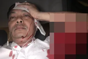 Giám đốc nhân sự Trung Nguyên bị đâm 