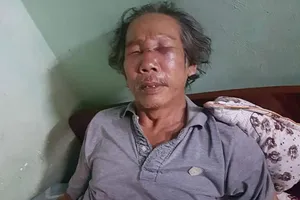Triệu tập bảo vệ chung cư đánh người già nhập viện