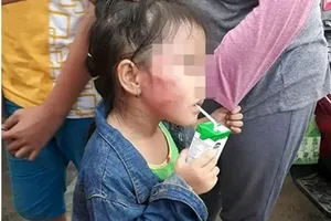 Bắt khẩn cấp cô giáo đánh trẻ nứt xương hàm ở Bình Chánh