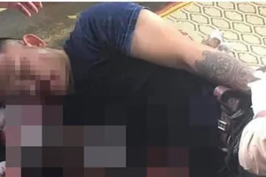 Sau tiếng nổ ở quán cà phê, thanh niên 30 tuổi bị nát bàn tay 