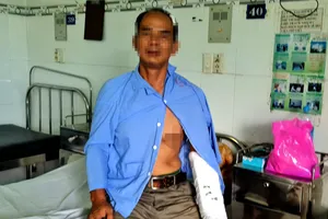 Nhân viên nhà máy nhiệt điện Vĩnh Tân 4 bị nhóm người lạ đánh gãy tay