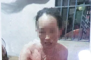 Đi nhậu về tưới xăng đốt vợ gây bỏng nặng