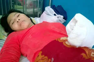 Đứt gân tay vì giằng co với cướp