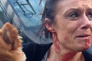 Một phụ nữ phải đổ máu để bảo vệ tính mạng chú chó cưng