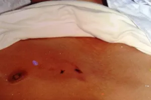 Tử vong sau khi rời trụ sở công an phường