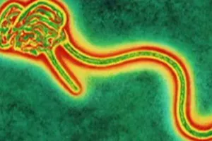 Cẩm nang Ebola - Bài 3: Làm thế nào để không nhiễm Ebola?