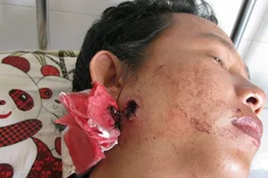 Vụ công an xã bắn người bị còng tay: Người bị bắn được tuyên vô tội 