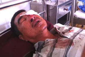 Bị cáo ném đá làm vỡ nhãn cầu hành khách bị phạt 4 năm tù