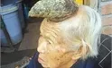 Cụ bà mọc sừng dài kỳ lạ trên đầu