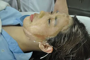 Tạm giữ một nghi can tạt acid nữ sinh giữa phố Sài Gòn