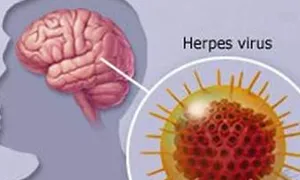 Cảnh báo vào mùa viêm não Nhật Bản