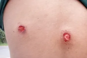 Một công dân phản ánh bị thiếu tá công an bắn vào lưng