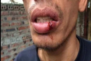 Sự thật về tin CSGT Hải Dương 'đánh người rách môi'