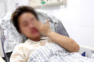 Sau 20 ngày, bệnh nhân ngừng tim do sạt lở đất ở Yên Bái được ra viện