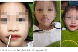 Cha phun xăm môi cho con gái 5 tuổi có phạm luật?
