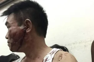 Hà Nội: Vợ chồng thanh tra xô xát với anh trai