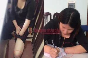 Thuê người chặt chân, tay kiếm 3,5 tỉ: Đề xuất phạt 1,5 triệu