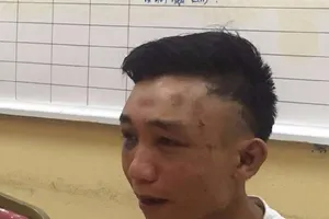 Vờ mua dầu gội, đâm gục rồi cướp túi xách của chủ quán