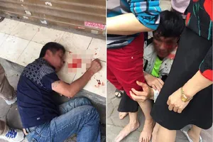 Bị người dân đánh nhập viện vì tưởng nhầm là trộm xe