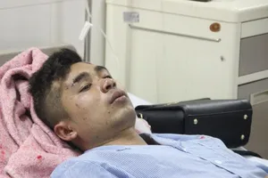 Nạn nhân trên xe khách nổ kể lại giây phút kinh hoàng 