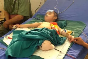 Đá đè sập nhà, bé trai 4 tuổi bị mất hai chi