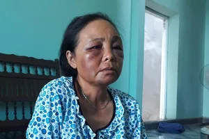 2 phụ nữ bị đánh vì nghi bắt cóc: Họ quá hung hãn!