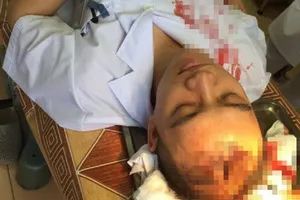 Kẻ đập ly thủy tinh vào đầu làm bác sĩ bất tỉnh lãnh án