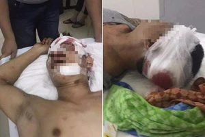 2 thanh niên bị nhóm 10 người cầm tuýp sắt truy sát