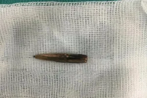 Yêu cầu Bộ Công an điều tra vụ trúng đạn ở Vĩnh Phúc