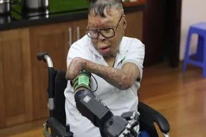 Chiến sĩ sống sót vụ trực thăng rơi được tặng tay giả 