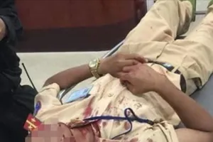 Bị dừng xe, tài xế cầm đá chọi CSGT nhập viện